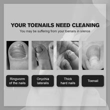 Load image into Gallery viewer, Last Day Promotion（50% OFF ）Medical-grade Nail Clippers - Libiyi